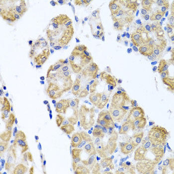 Anti-GLS Antibody (CAB3885)