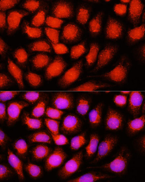 Anti-DNAJB14 Antibody (CAB4990)