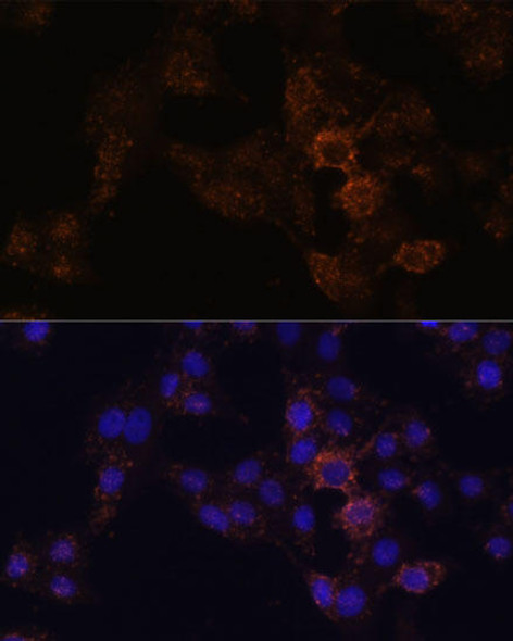 Anti-GRP Antibody (CAB6380)