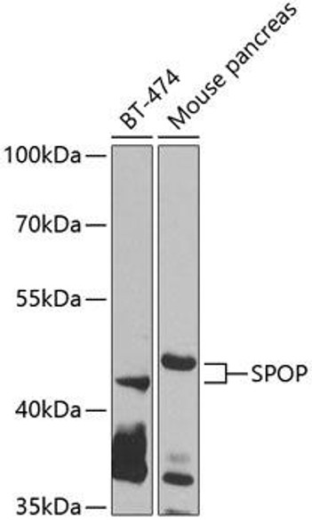 Anti-SPOP Antibody (CAB7621)