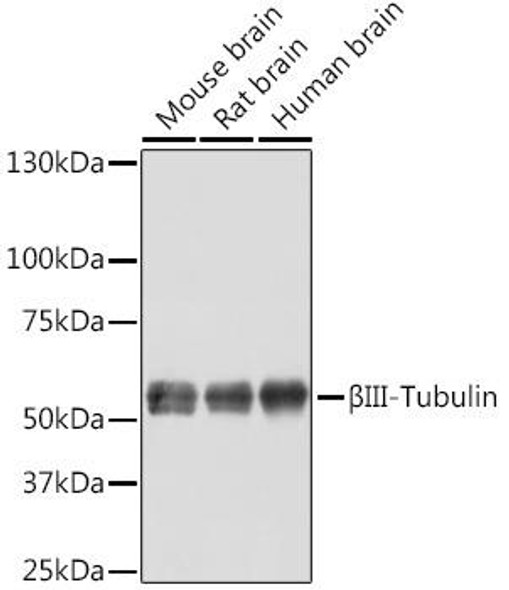 Anti-BetaIII-Tubulin Antibody (CAB11933)