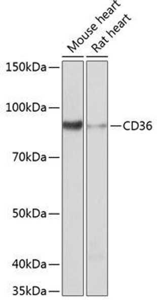 Anti-CD36 Antibody (CAB19016)