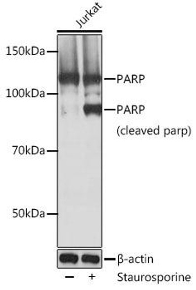 Anti-PARP Antibody [KO Validated] (CAB19596)