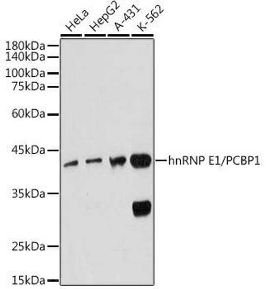 Anti-hnRNP E1/PCBP1 Antibody (CAB19276)