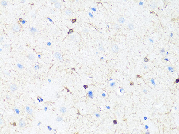 Anti-TH Antibody (CAB0028)