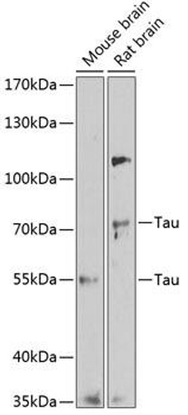 Anti-Tau Antibody (CAB1103)