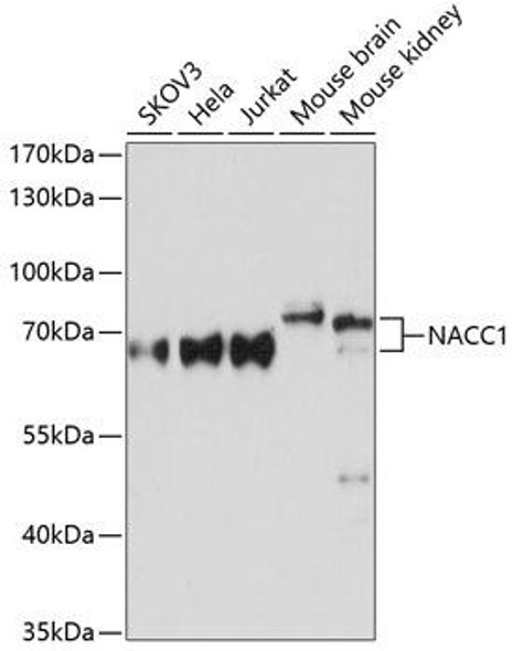 Anti-NACC1 Antibody (CAB11720)