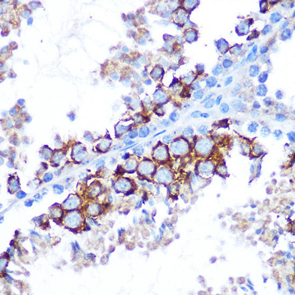 Anti-TAK1 Antibody (CAB12022)