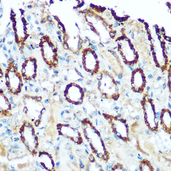 Anti-NDUFS4 Antibody (CAB13519)