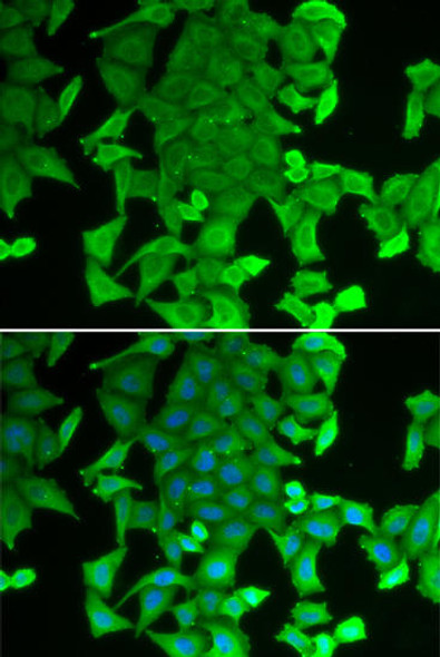 Anti-RFFL Antibody (CAB13604)