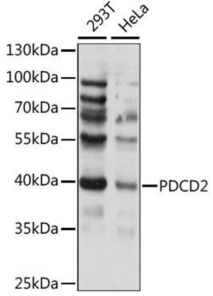 Anti-PDCD2 Antibody (CAB15299)