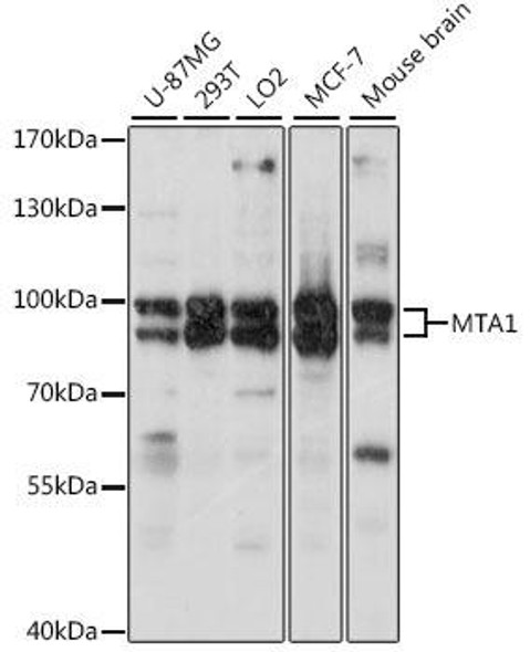 Anti-MTA1 Antibody (CAB16085)