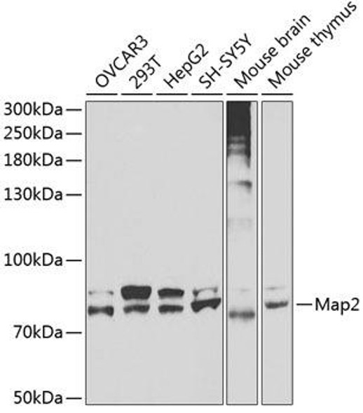 Anti-Map2 Antibody (CAB3278)