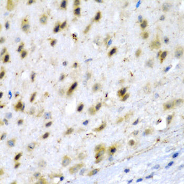 Anti-TPH2 Antibody (CAB7147)