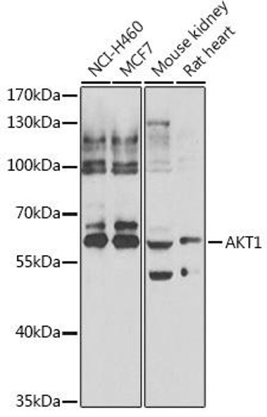 Anti-AKT1 Antibody (CAB7270)