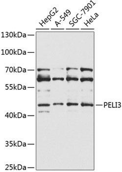 Anti-PELI3 Antibody (CAB9999)