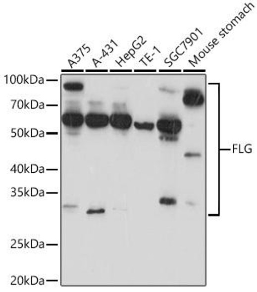 Anti-FLG Antibody (CAB20011)