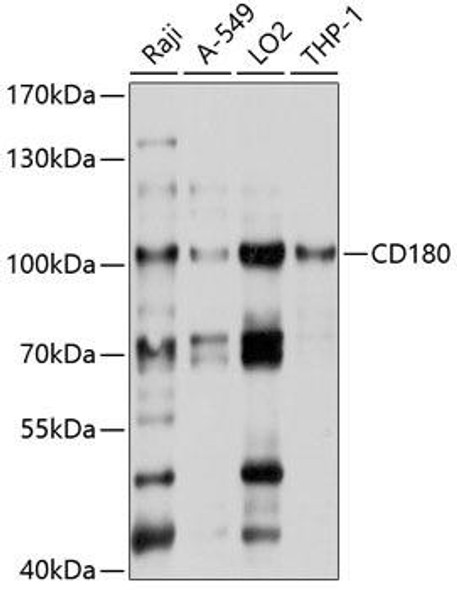 Anti-CD180 Antibody (CAB10226)