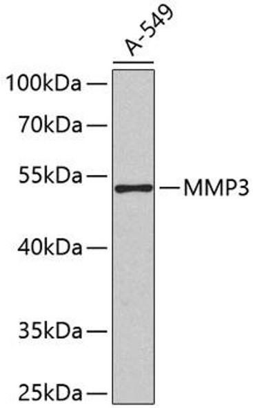 Anti-MMP3 Antibody (CAB2426)