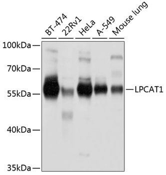Anti-LPCAT1 Antibody (CAB4987)