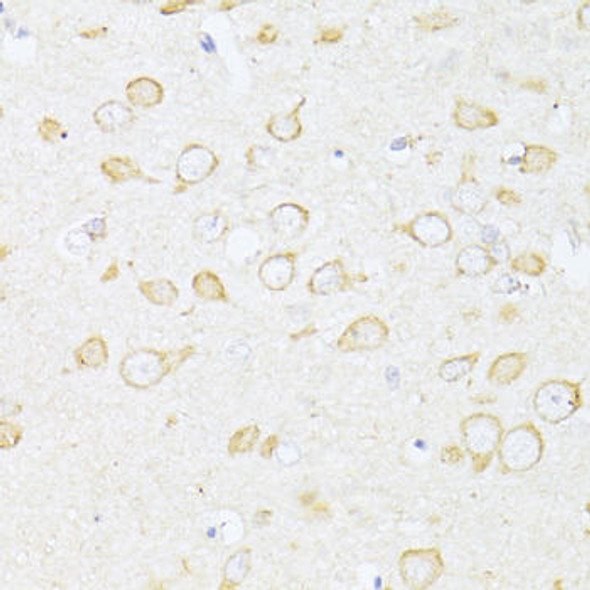 Anti-SQSTM1 / p62 Antibody (CAB7758)