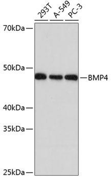 Anti-BMP4 Antibody (CAB11405)