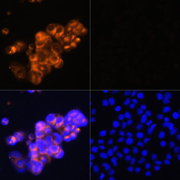 Anti-AFP Antibody (CAB17457)