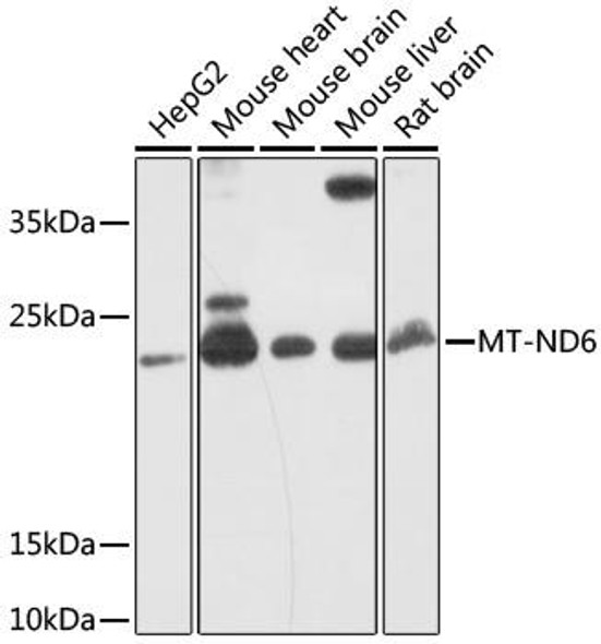 Anti-MT-ND6 Antibody (CAB17991)