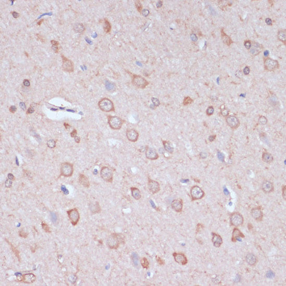 Anti-CARTPT Antibody (CAB18275)