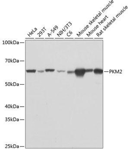 Anti-PKM2 Antibody (CAB19102)