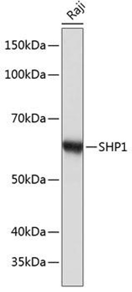 Anti-SHP1 Antibody (CAB19111)