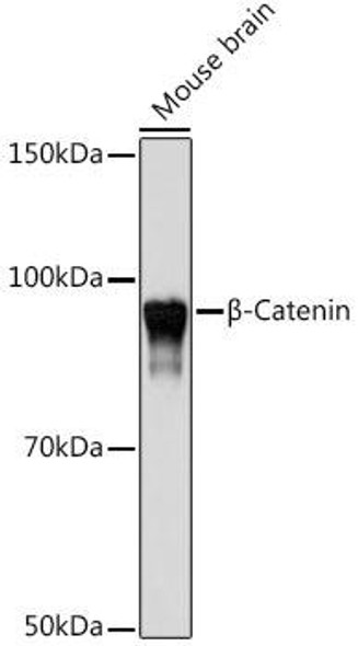 Anti-Beta-Catenin Antibody [KO Validated] (CAB19657)