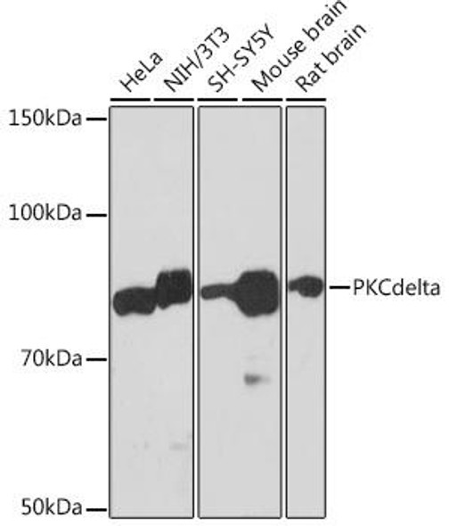 Anti-PKCdelta Antibody (CAB7778)