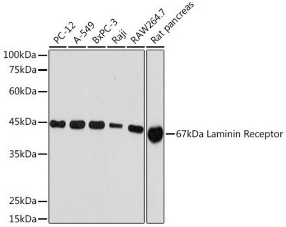 Anti-67kDa Laminin Receptor Antibody (CAB5968)
