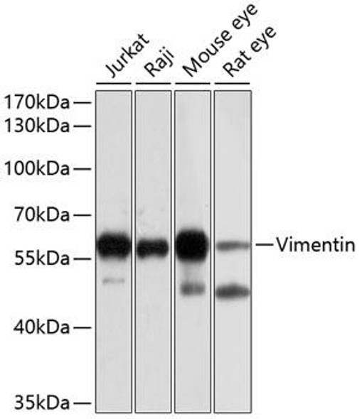 Anti-Vimentin Antibody (CAB0326)