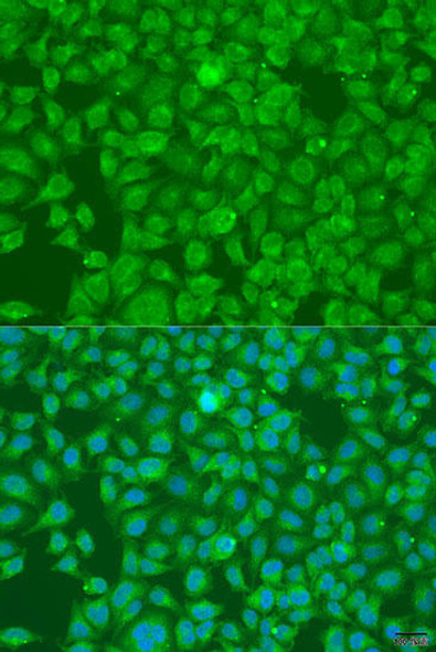 Anti-SLC25A6 Antibody (CAB15029)