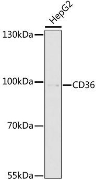 Anti-CD36 Antibody (CAB17339)