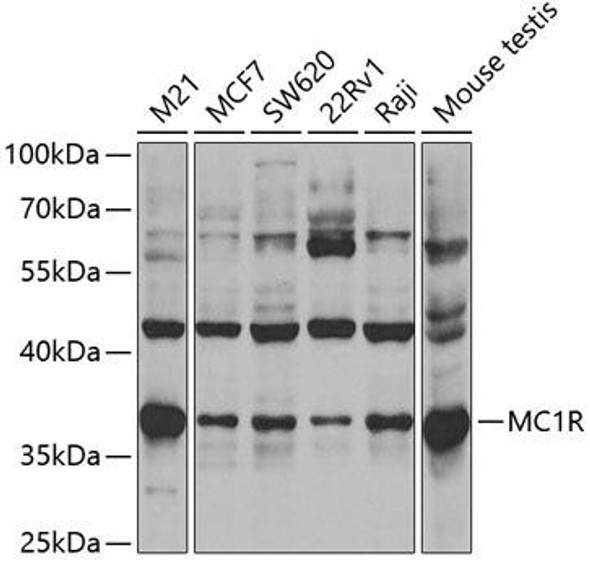 Anti-MC1R Antibody (CAB3009)