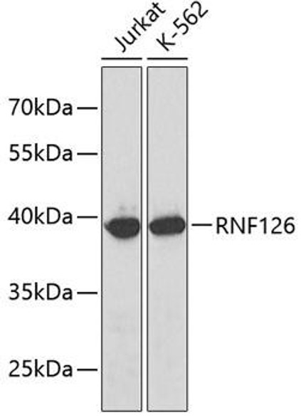 Anti-RNF126 Antibody (CAB3081)
