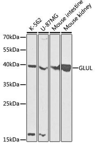 Anti-GLUL Antibody (CAB5437)[KO Validated]