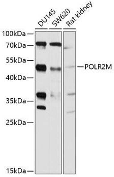 Anti-POLR2M Antibody (CAB10327)