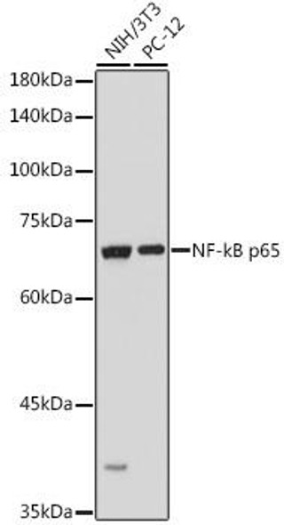 Anti-NF-kB p65 Antibody (CAB11202)