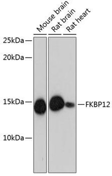 Anti-FKBP12 Antibody (CAB11641)