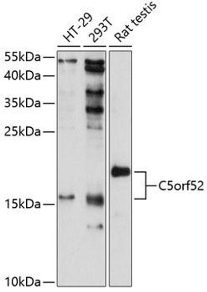 Anti-C5orf52 Antibody (CAB11987)