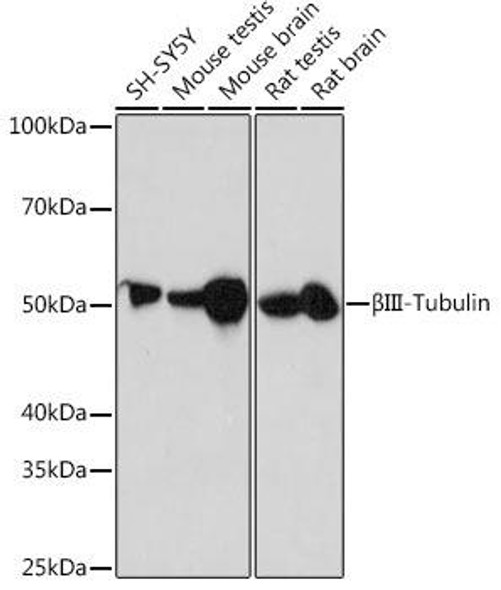 Anti-BetaIII-Tubulin Antibody (CAB17913)