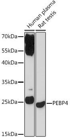Anti-PEBP4 Antibody (CAB17961)