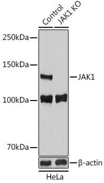 Anti-JAK1 Antibody (CAB18323)[KO Validated]