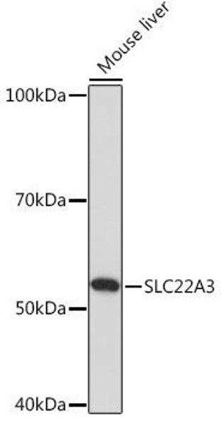 Anti-SLC22A3 Antibody (CAB18588)
