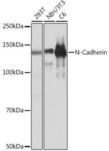 Anti-N-Cadherin Antibody [KO Validated] (CAB19083)