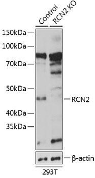 Anti-RCN2 Antibody (CAB19943)[KO Validated]